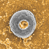 Ugly duckling poly-donuts - Polymer electrolyte complexes can form particles with diverse shapes like bread dough. The electron microscopy image shows an uncommon donut-shaped (or toroidal) particle surrounded by spherical nanoparticles formed when drying the polymer electrolyte mixtures. Wangsuk Oh, Xiao Su lab, Dept of Chemical & Biomolecular Engineering